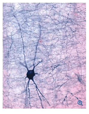 Leica VT1000 S Vibrating blade microtome - Image 3