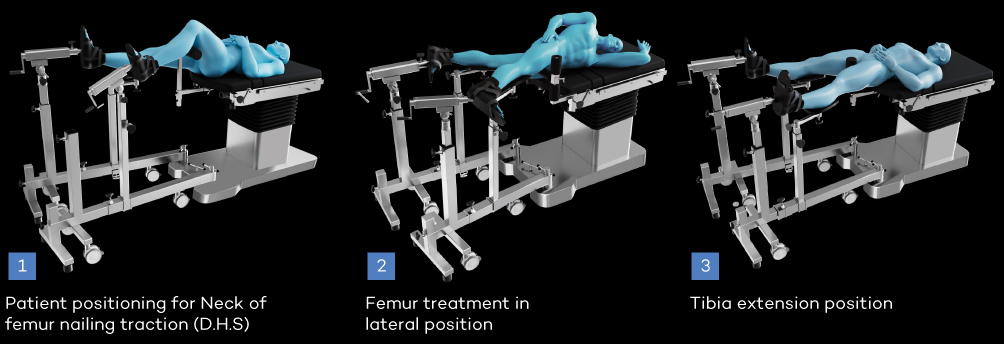Albee,s Type Ortho Attachment - Image 2