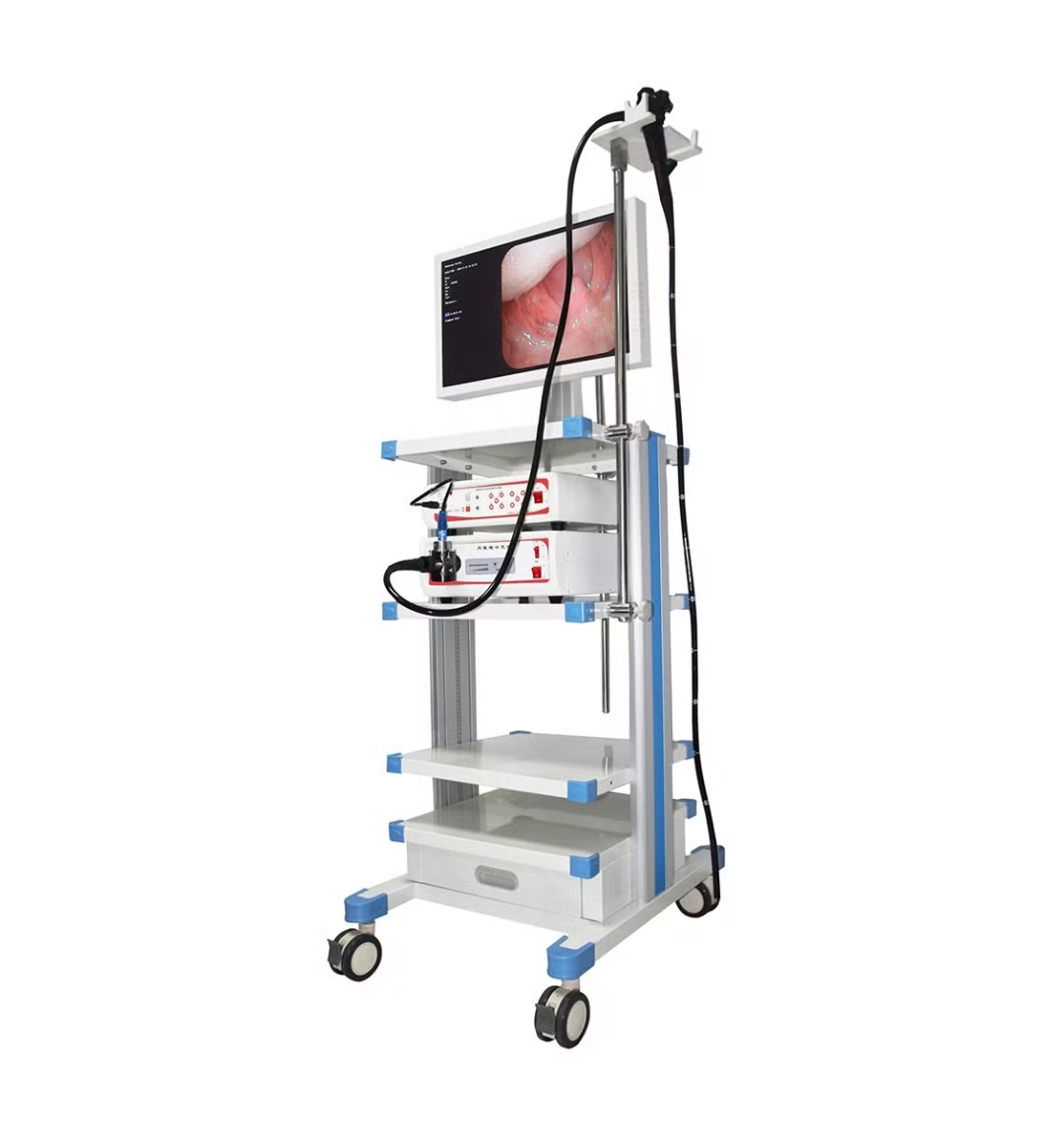 DEXUP Video Endoscopy System